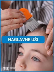 Naglavne uši so nadležne, niso pa nevarne